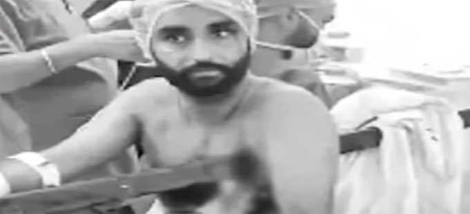 Punjab: ఛాతిలోకి ఆరడుగుల రాడ్డు దూసుకెళ్లినా మరణాన్ని జయించాడు - Vimarsana News
