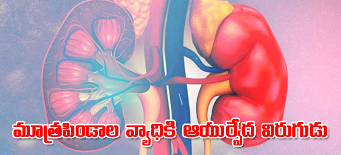 Kidney Disease: మూత్రపిండాల వ్యాధికి ఆయుర్వేద విరుగుడు - Vimarsana News